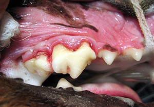 Stage 3 Periodontal Disease